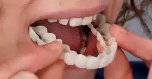 replace just one tooth